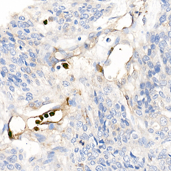 S100A12 Rabbit polyclonal antibody