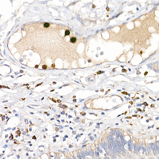 S100A12 Rabbit polyclonal antibody