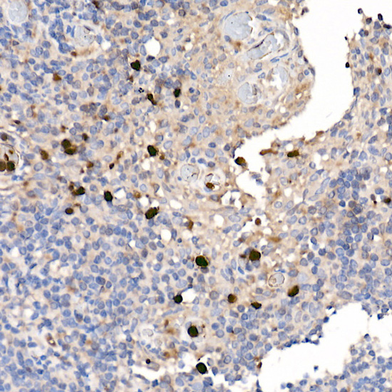 S100A12 Rabbit polyclonal antibody