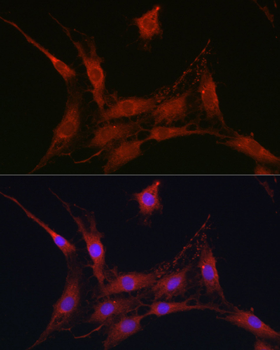 SLC4A4 / NBC Rabbit polyclonal antibody