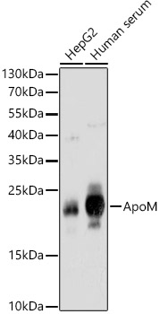 ApoM Rabbit polyclonal antibody