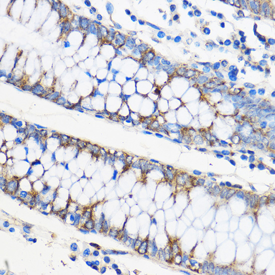 ApoM Rabbit polyclonal antibody