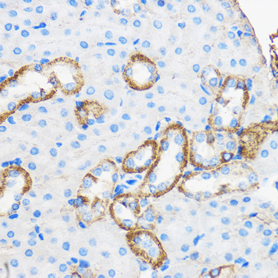 ApoM Rabbit polyclonal antibody