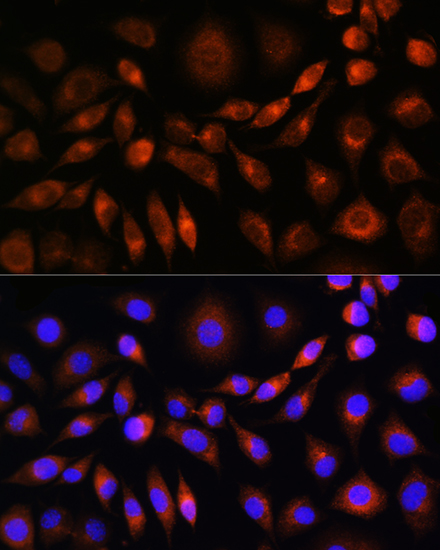 ApoM Rabbit polyclonal antibody