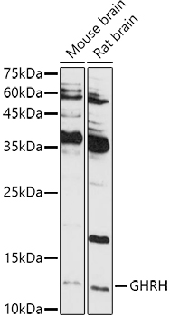 GHRH Rabbit polyclonal antibody