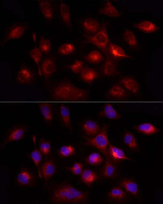 GHRH Rabbit polyclonal antibody