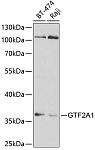 Western blot - GTF2A1 Rabbit pAb (A5345)