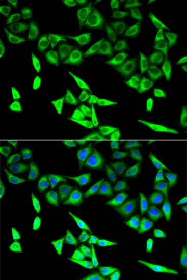 [KO Validated] HADHA Rabbit polyclonal antibody