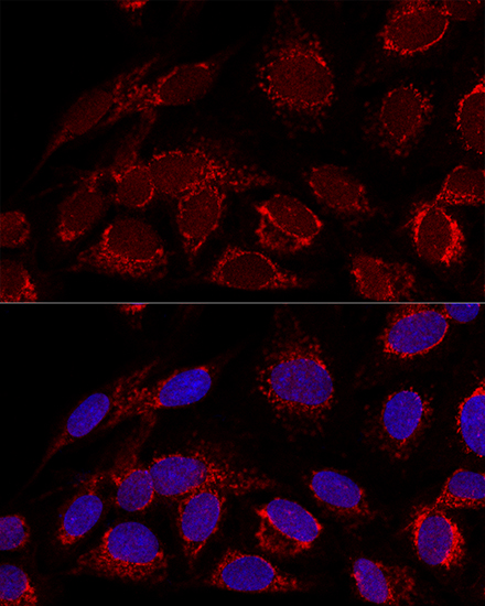 [KO Validated] HADHA Rabbit polyclonal antibody