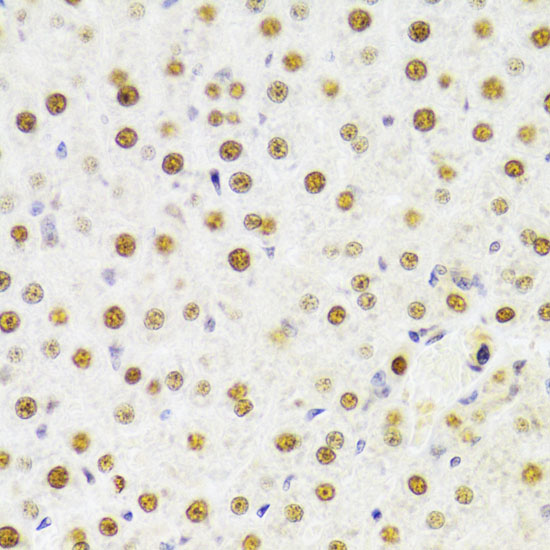 HDGF Rabbit polyclonal antibody