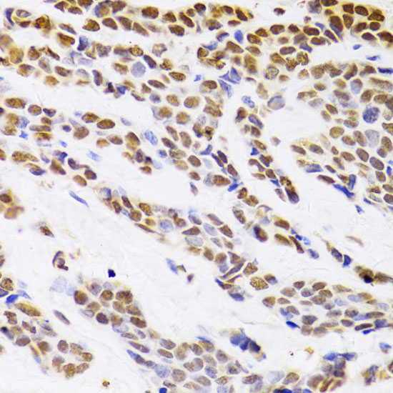 HDGF Rabbit polyclonal antibody