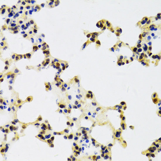 HDGF Rabbit polyclonal antibody
