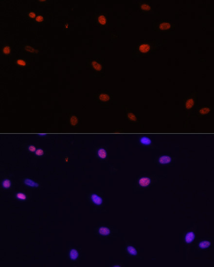 HDGF Rabbit polyclonal antibody