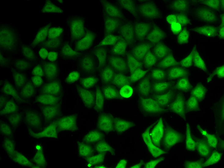 IMPDH2 Rabbit polyclonal antibody