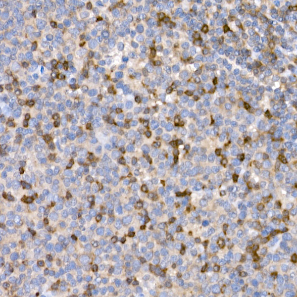 LTBR Rabbit polyclonal antibody