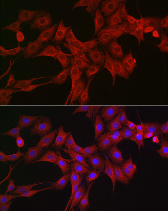 LTBR Rabbit polyclonal antibody