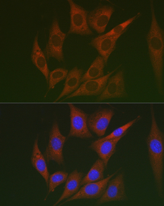 Lumican (LUM) Rabbit polyclonal antibody