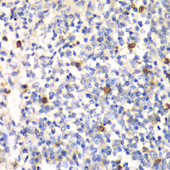 PSMD7 Rabbit polyclonal antibody