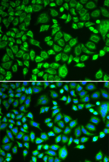 PSMD7 Rabbit polyclonal antibody
