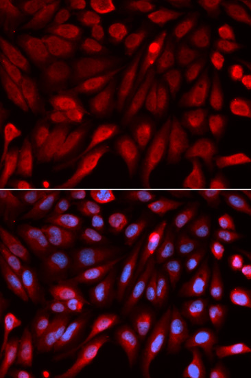 Syntenin Rabbit polyclonal antibody