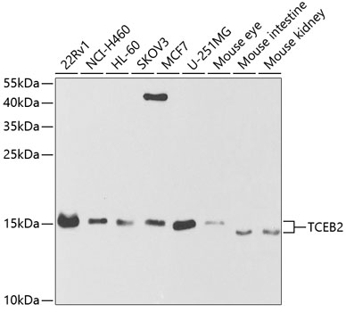 TCEB2 Rabbit polyclonal antibody