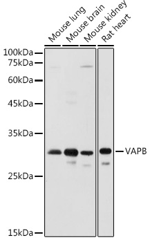 VAPB Rabbit polyclonal antibody