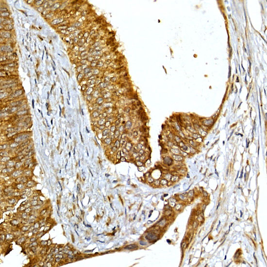 VAPB Rabbit polyclonal antibody