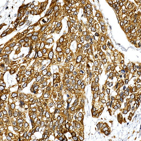 VAPB Rabbit polyclonal antibody
