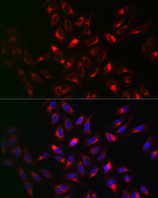 VAPB Rabbit polyclonal antibody