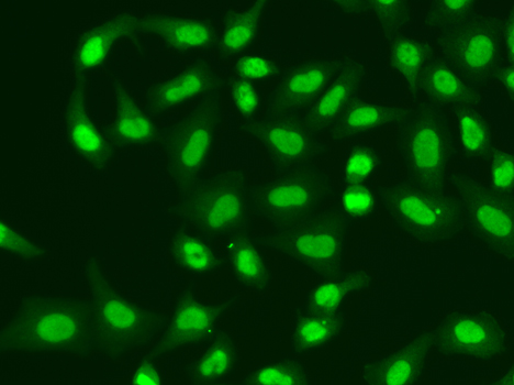 APTX Rabbit polyclonal antibody