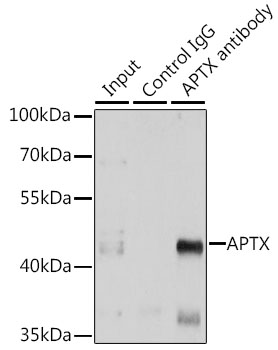 APTX Rabbit polyclonal antibody