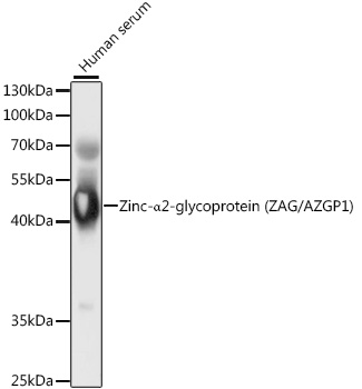 Zinc-α2-glycoprotein (ZAG/AZGP1) Rabbit pAb