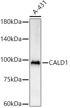 CALD1 Rabbit polyclonal antibody