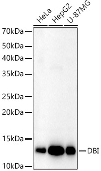 DBI Rabbit polyclonal antibody