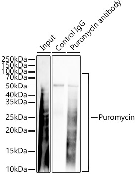 DBI Rabbit polyclonal antibody