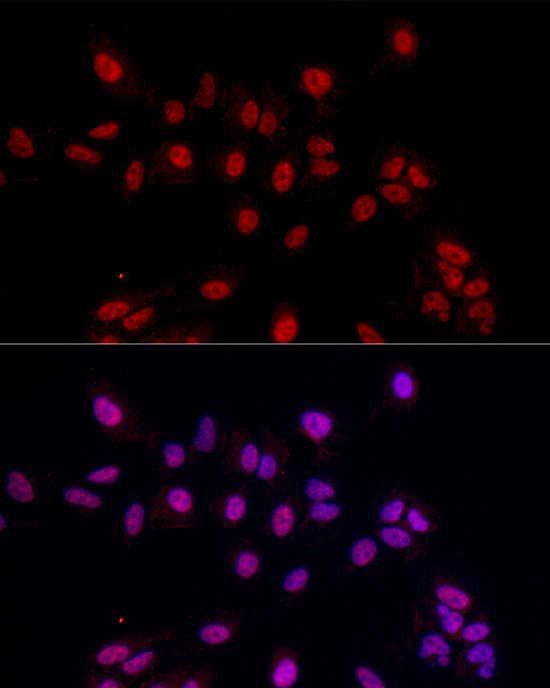 EED Rabbit polyclonal antibody