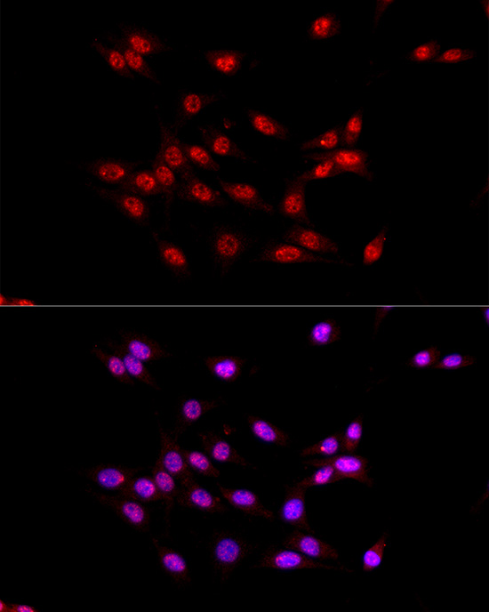 EED Rabbit polyclonal antibody