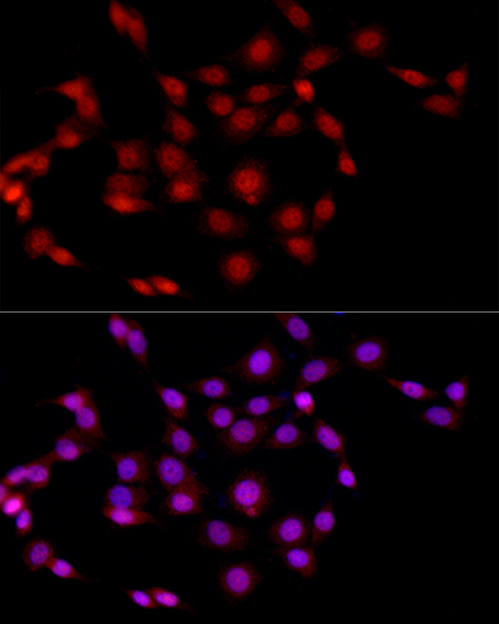 EED Rabbit polyclonal antibody
