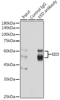 EED Rabbit polyclonal antibody