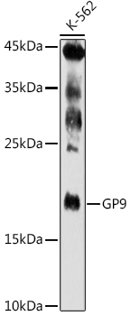 GP9 Rabbit polyclonal antibody