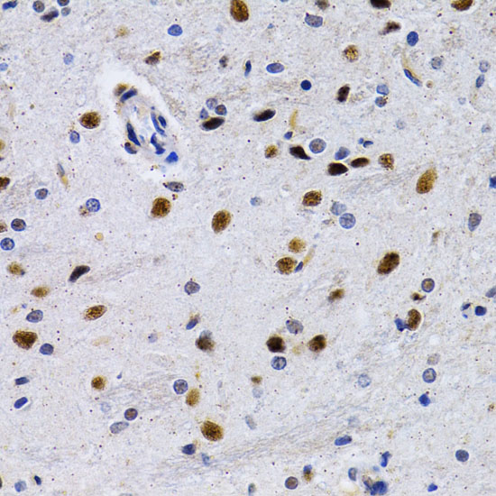 ID3 Rabbit polyclonal antibody