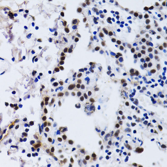 ID3 Rabbit polyclonal antibody