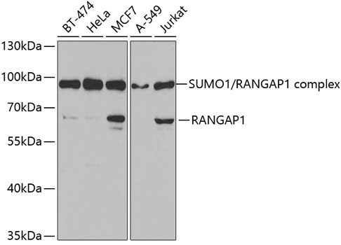 RanGAP1 Rabbit pAb