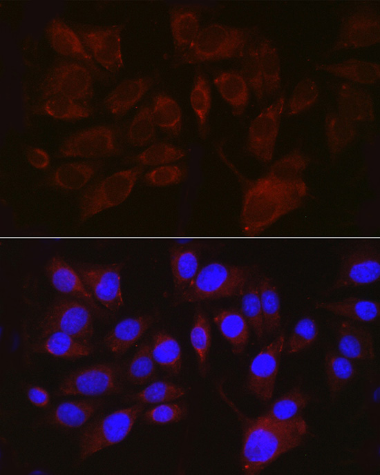 PMEL Rabbit polyclonal antibody