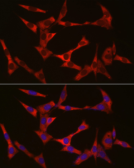 WIF1 Rabbit polyclonal antibody