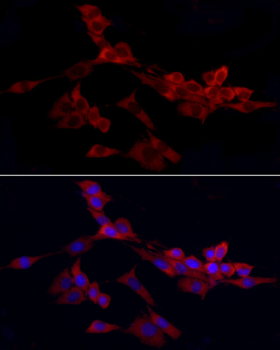 WIF1 Rabbit polyclonal antibody