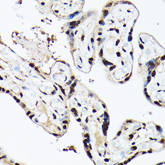 ACTL6A Rabbit polyclonal antibody