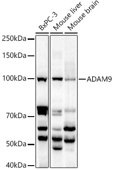 ADAM9 Rabbit polyclonal antibody