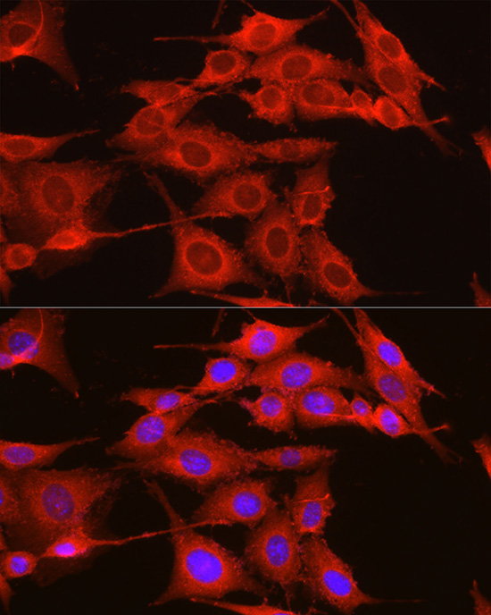ADAM9 Rabbit polyclonal antibody