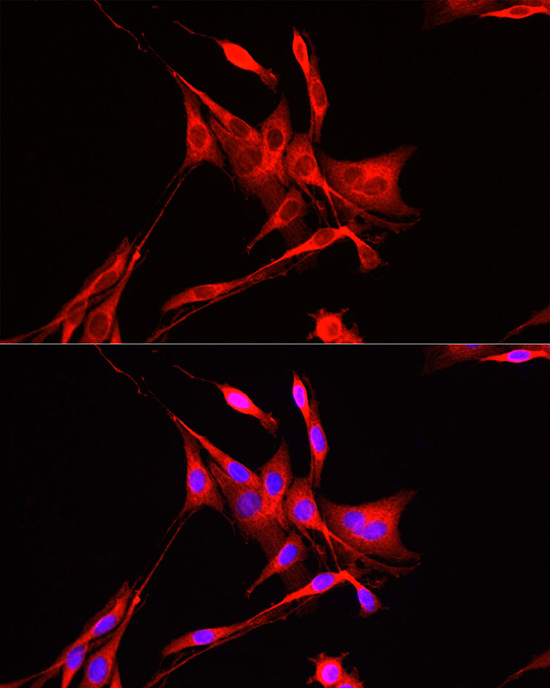 ADAM9 Rabbit polyclonal antibody